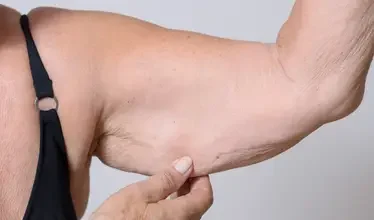 liposuction_other_services.webp