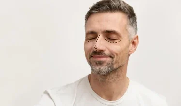 rhinoplasty_man_other_services